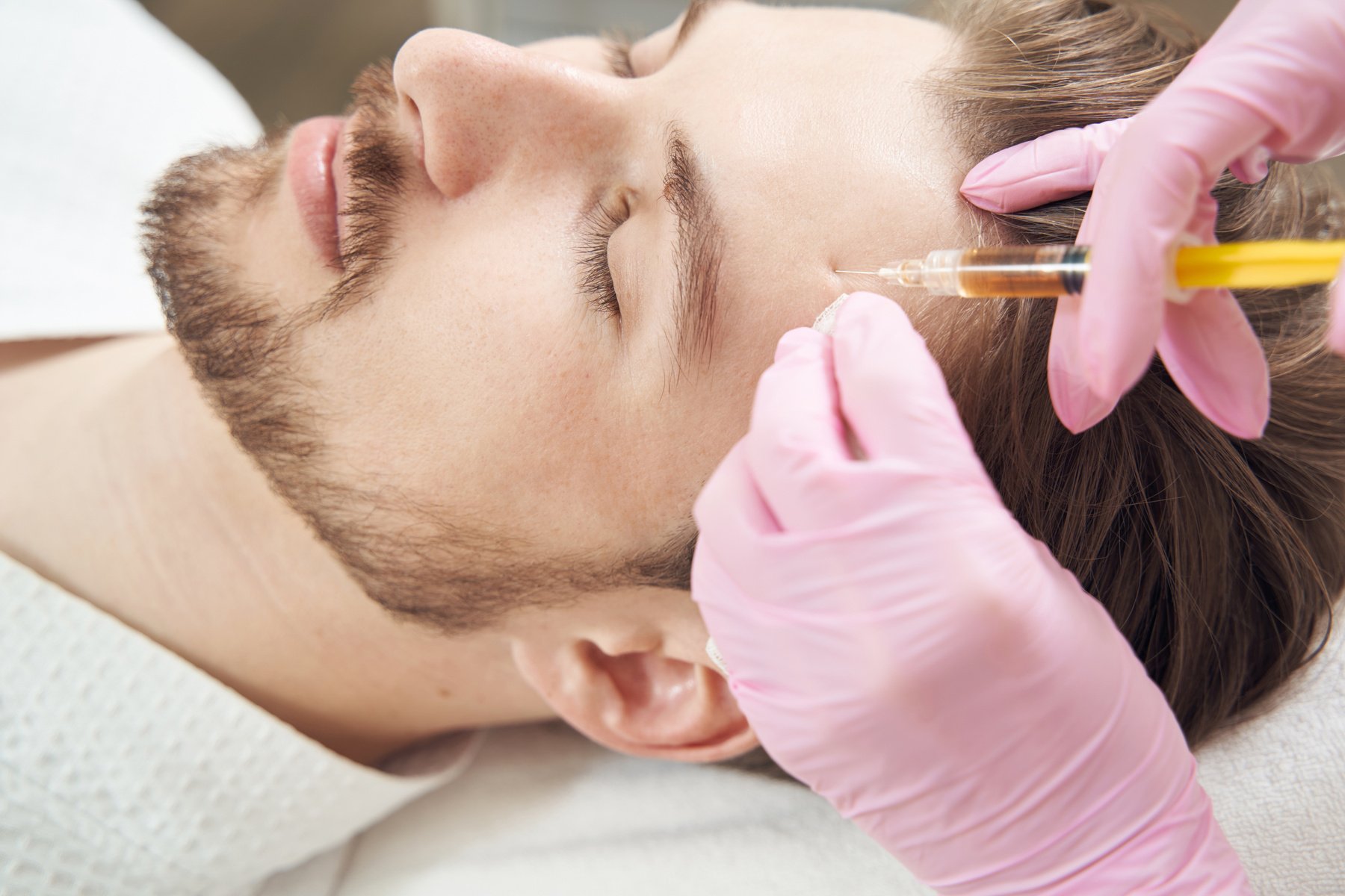 Plasmolifting treatment on male forehead in aesthetic medicine clinic